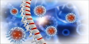 Bone Marrow Transplant