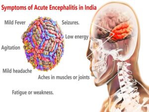 acute encephalitis