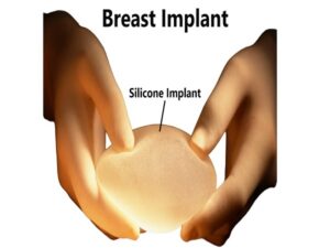 Breast Implant