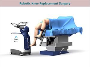 Robotic Knee Replacement Surgery Cost in India | تكلفة جراحة استبدال ...