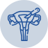 Hysterectomy Hysterectomy